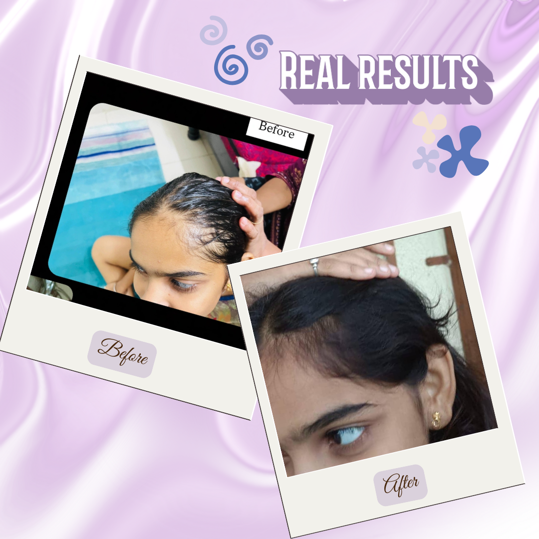 The Cascote Hair Growth Oil | Rosemary & Tea Tree Oil for Faster Hair Growth & Reduced Hair Fall (50ml / 100ml)