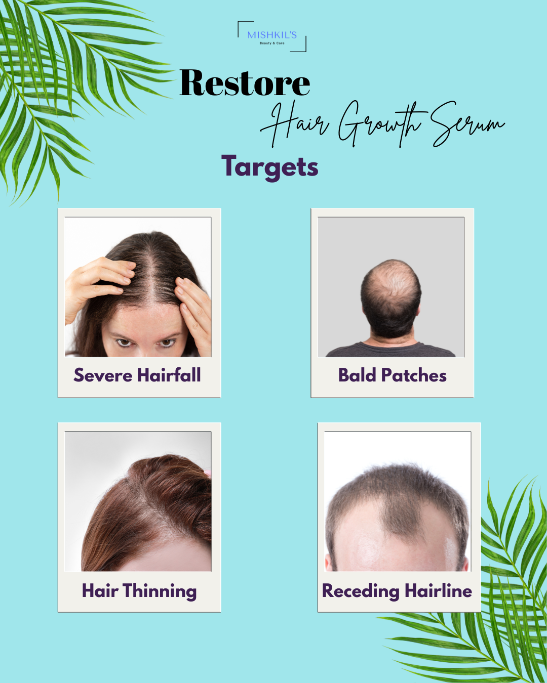 Restore Hair Growth Serum | Redensyl, Anagain, Saw Palmetto & Rosemary Oil | For Hair Regrowth, Bald Patches, Thicker & Fuller Hair | 10 ml
